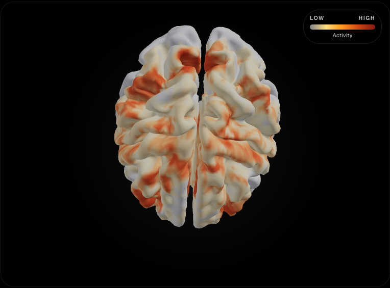 Brain attention placeholder